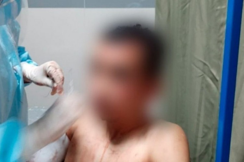Delincuentes le cortaron la cara y los brazos a un venezolano para robarlo en Perú 30